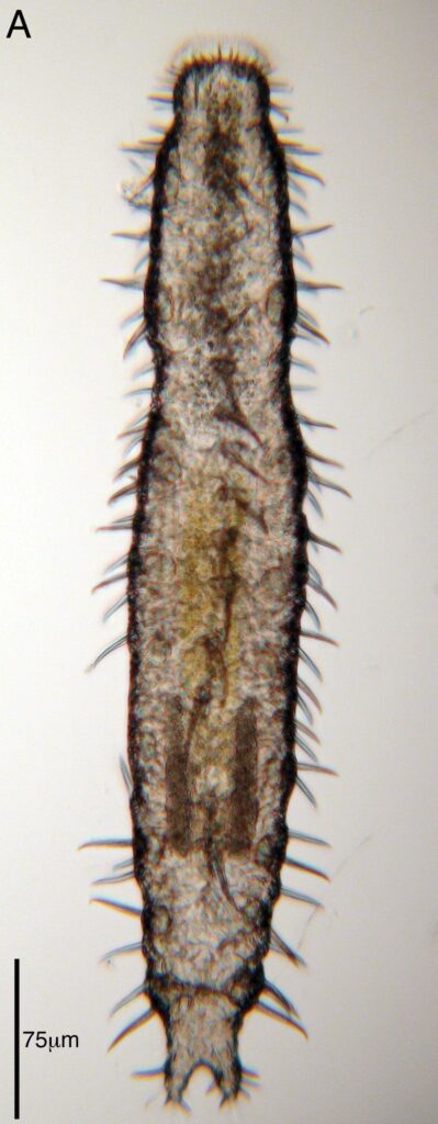 Acanthodasys caribbeanensis Acanthodasys caribbeanensis