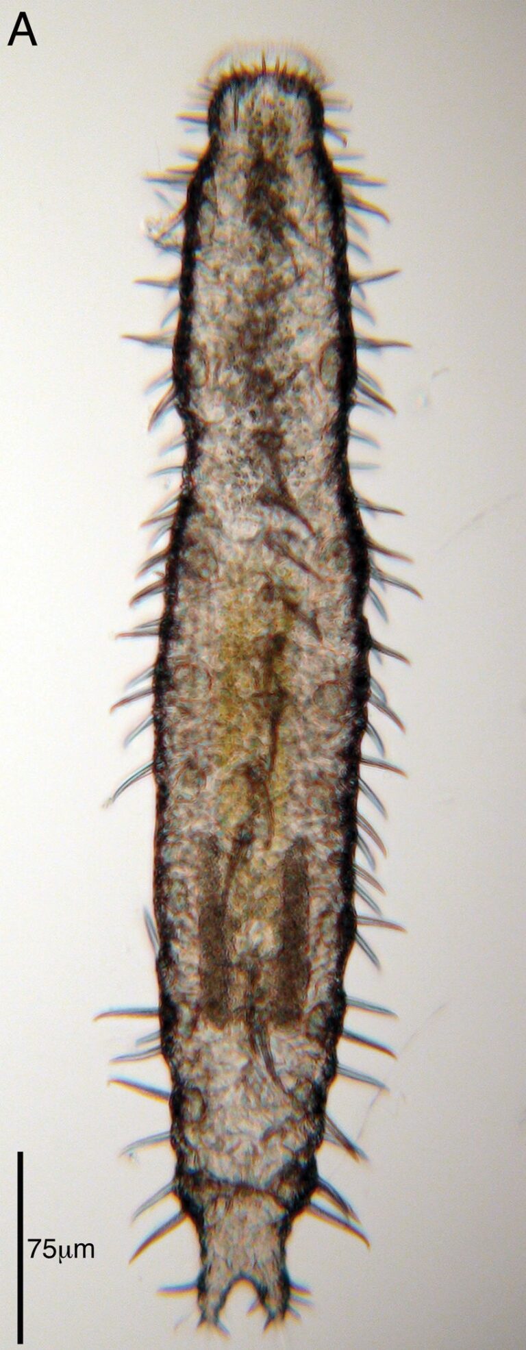 Acanthodasys caribbeanensis Acanthodasys caribbeanensis
