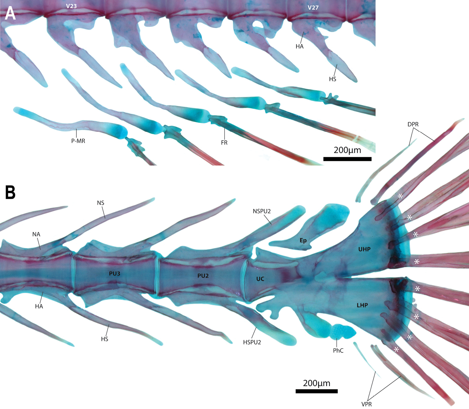 Barryichthys hutchinsi (Barryichthys hutchinsi) |commons:File:Barryichthys hutchinsi (10.3897-zookeys.864.34521) Figure 10.jpg