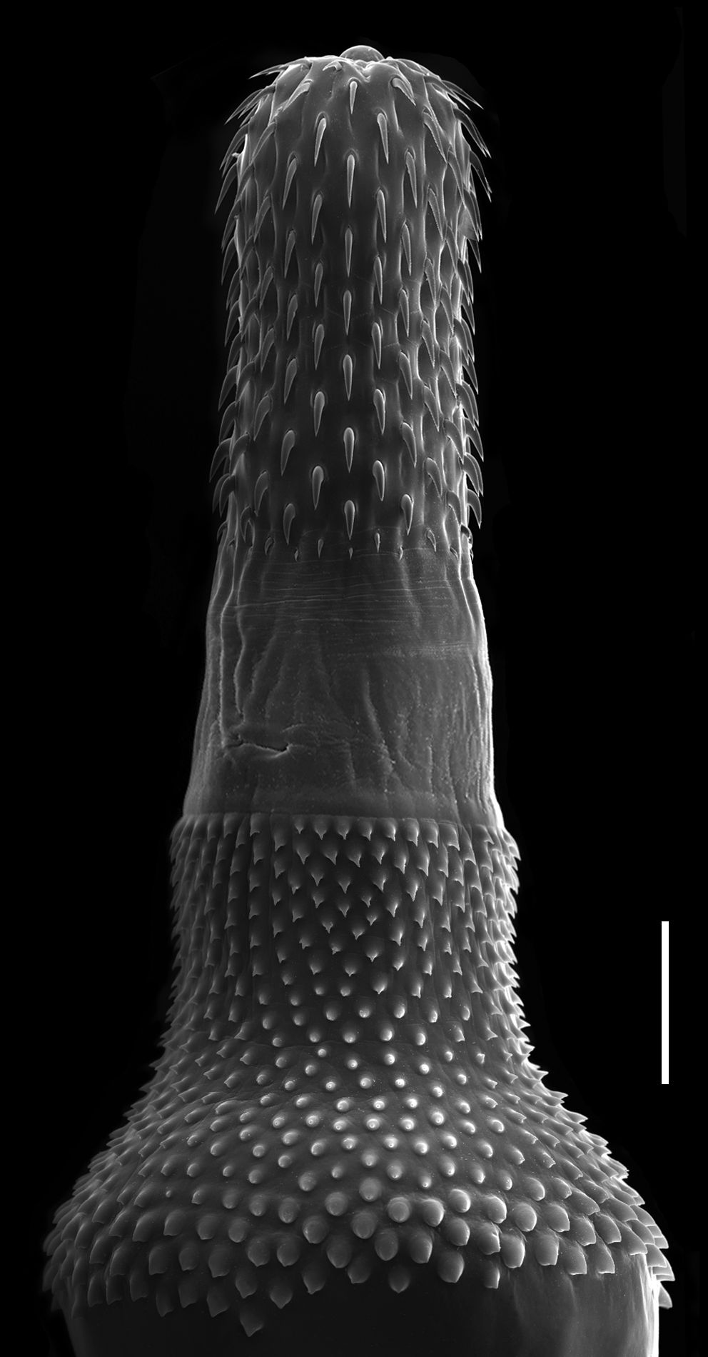 Bolbosoma turbinella Bolbosoma turbinella