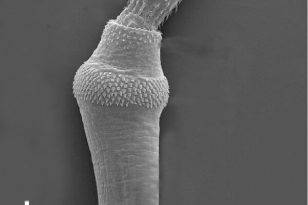 Bolbosoma vasculosum Bolbosoma vasculosum
