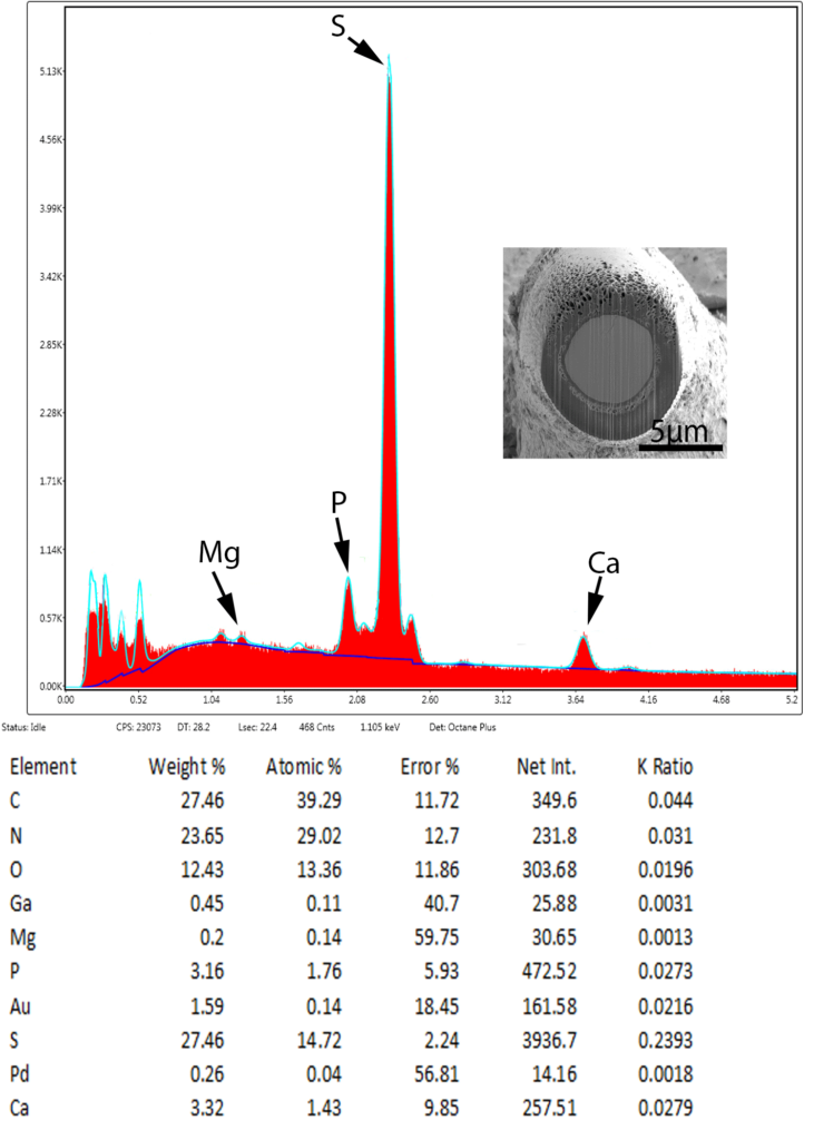 Cavisoma magnum Cavisoma magnum