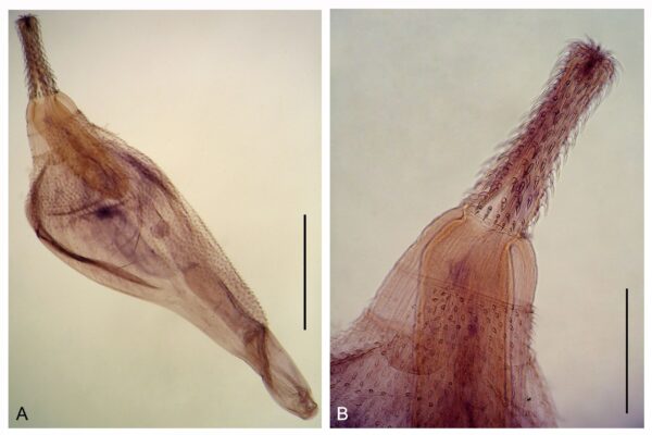 Corynosoma cetaceum Corynosoma cetaceum