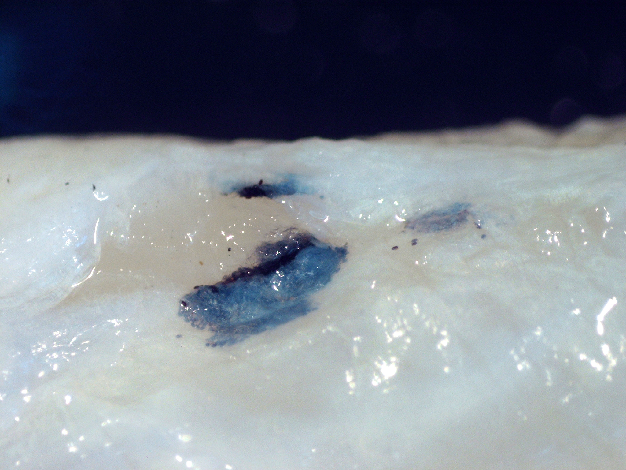 Daggertooth Pike Conger (Muraenesox cinereus) |commons:File:Huffmanela hamo eggs in Muraenesox cinereus 1B.JPG