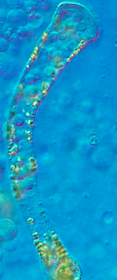 Dicyema clavatum Dicyema clavatum