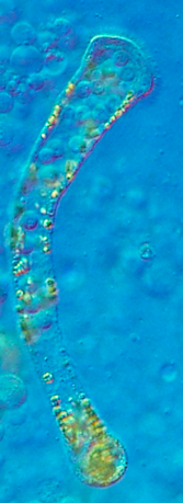 Dicyema clavatum Dicyema clavatum