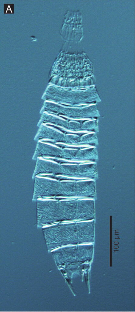 Echinoderes hwiizaa Echinoderes hwiizaa