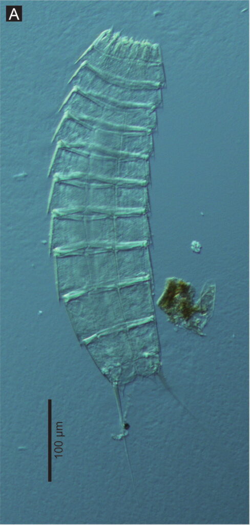 Echinoderes komatsui Echinoderes komatsui