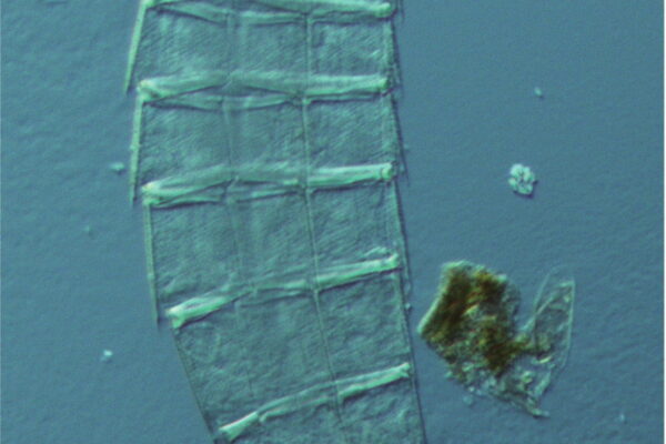 Echinoderes komatsui Echinoderes komatsui