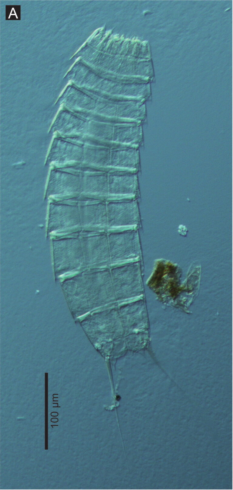 Echinoderes komatsui Echinoderes komatsui