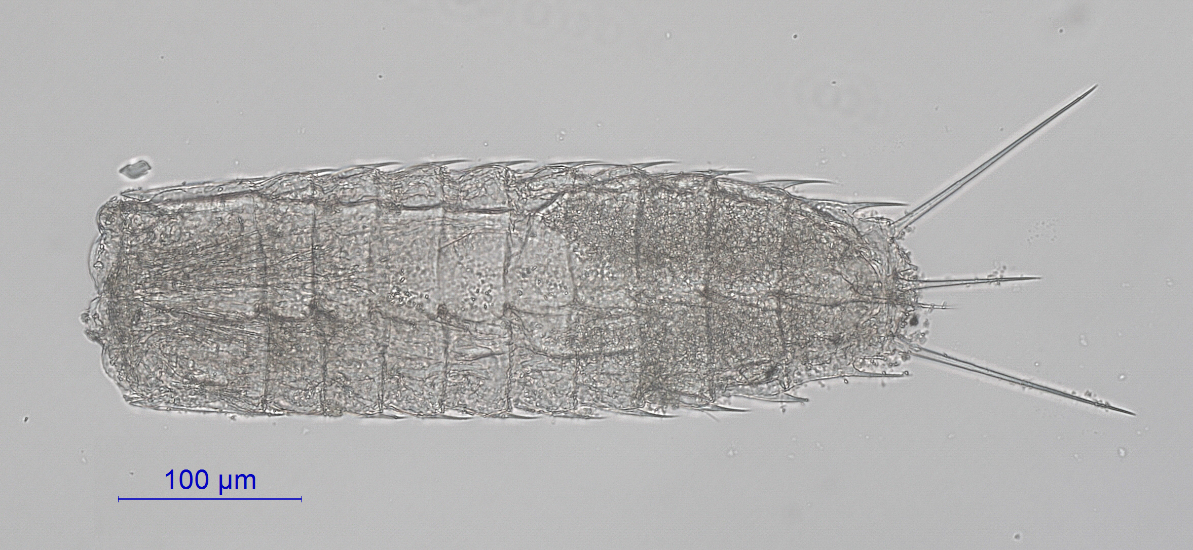 Paracentrophyes quadridentatus Paracentrophyes quadridentatus