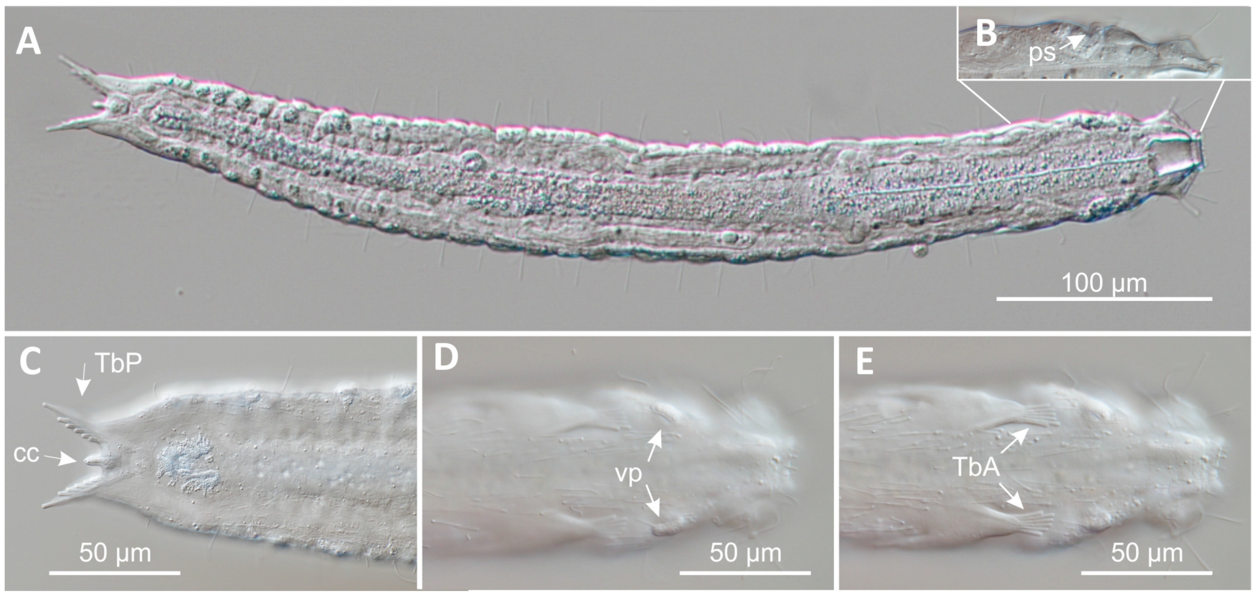Paraturbanella teissieri Paraturbanella teissieri